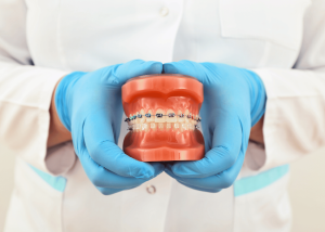 Do Braces Make Your Lips Bigger?