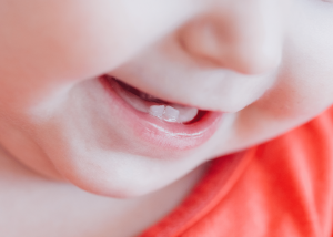 “Discover the 5 Best Mouthwashes to Keep Your Tongue Piercing Clean and Healthy: Expert Tips on Finding the Right Oral Hygiene Product for your Oral Care!”